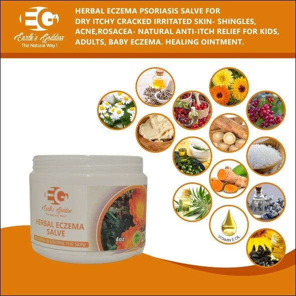 ezema-1.jpg Herbal Eczema Healing Salve - Image 1